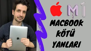 M1 MacBook Pro Kötü Yanları