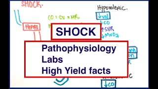 Shock: Types | Cardiac output, PCWP, SVR | MCQs | USMLE