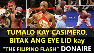 TUMALO KAY CASIMERO, BITAK ANG EYE LID KAY DONAIRE