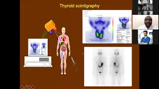 2- Thyroid and parathyroid scintigraphy by dr. Jawa