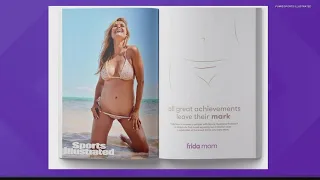 Model with C-section scar graces cover of Sports Illustrated