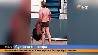 В Красноярском крае засняли мужчину, которого с головы до ног поела мошка