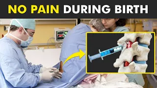 How Epidural Injection is Given And How it Works? (Pain Free Birth)