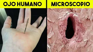 Este microscopio POTENTE logro tomar esta fotografia Imposible