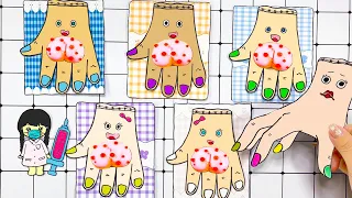 Paper DIY ASMR Pop the pimples | Wednesday has pimples | Baby Care Tips | Dodo Paper Craft Diy