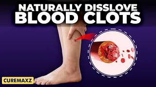 7 Foods to Melt Away Blood Clots