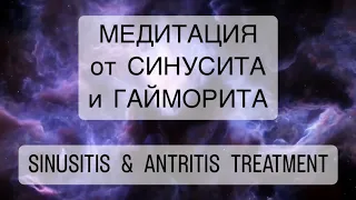 🧘‍♀️Сильнейшая медитация от СИНУСИТА психосоматика ГАЙМОРИТ лечение, SINUSITIS ANTRITIS TREATMENT