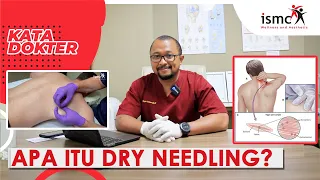 APA ITU DRY NEEDLING DAN BAGAIMANA EFEKNYA?  | dr. Daniel Wattimury, Sp.KO