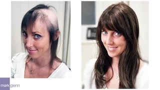 Female Hair Loss Solution - Mark Glenn Hair Enhancement, London