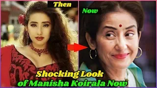 Surprising Look of Manisha Koirala Now