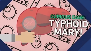 The Curious Case Of Typhoid Mary | Earth Science