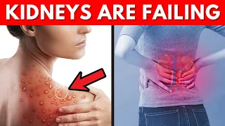 13 Warning Signs Your Kidneys Are Failing - Don't Ignore These Symptoms