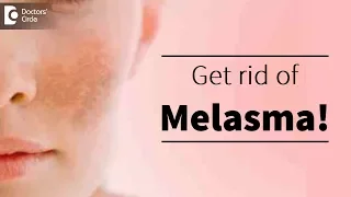 Melasma or pigmentation of skin. Treatment available? - Dr. Deepak P Devakar