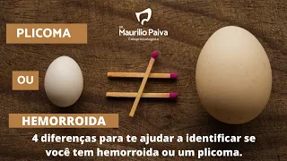 Plicoma ou hemorroida? 4 diferenças para te ajudar a identificar se você tem hemorroida ou plicoma