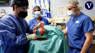 Un hombre recibe por primera vez el trasplante de un corazón de cerdo