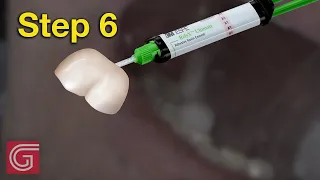 Cementing Zirconia Crown for  Molar Prep #shorts: Step 6
