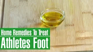 3 Best Home Remedies To TREAT ATHLETE'S FOOT (ITCHING, SCALING & REDNESS)