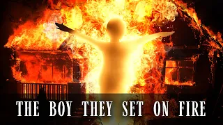 The Boy They Set On Fire - The Harrowing True Story