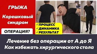 История лечения грыжи с корешковым синдром, которая привела к перекосу туловища.