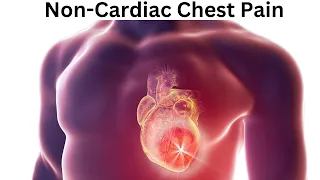 5 Causes of Non-Cardiac Chest Pain