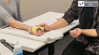 Finding Motor Points for Functional Electrical Stimulation in Hand Therapy  |  Technique Peek Series
