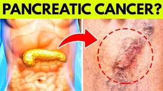 8 DANGEROUS Signs Of PANCREATIC CANCER That Require URGENT ATTENTION
