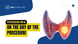 Thyroid Radiofrequency Ablation (RFA) - On the Day of your Procedure