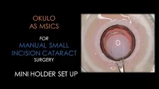 BIONIKO OKULO MSICS - Manual Small Incision Cataract Surgery