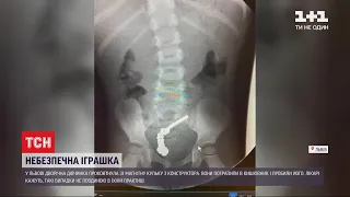 Маленьку львів'янку ледь не вбила популярна іграшка