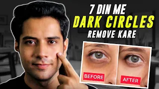 how to remove dark circles | how to remove dark circles under eyes at home| Dark spots from face