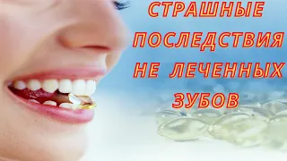 Состояние зубов влияет на здоровье всего организма