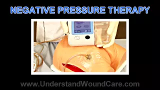 Negative Pressure Therapy: Part 1 of 4- Understand Wound Care