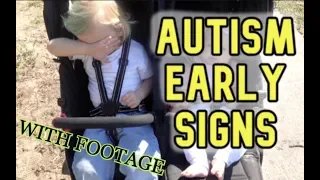 AUTISM EARLY SIGNS | Two Years Old (Incl. Footage)