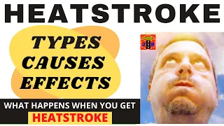 What happens when you attacked by Heatstroke? Heatstroke definition types & effects #safetyfirstlife