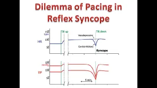 ESC Guidelines, Pacing for Reflex Syncope