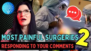 Top 7 Most Painful Surgeries Part 2 | Responding To Comments