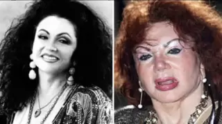 Top Ten Worst Plastic Surgery Disasters.