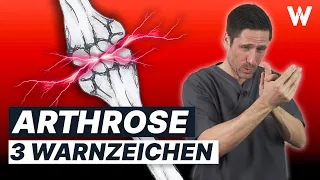 Arthrose feststellen: Die ersten WARNZEICHEN, dass Du betroffen bist!