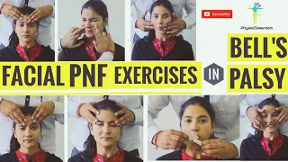 FACIAL PNF EXERCISES IN BELL'S PALSY