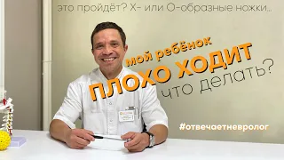 Мой ребёнок ПЛОХО ХОДИТ. Что делать? Отвечает невролог