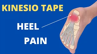 How to treat a painful heel / plantar fasciitis with Kinesiology Taping