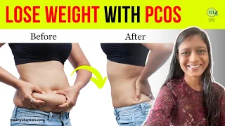 PCOS Weight Loss: 5 Amazing Ways to Beat Insulin Resistance