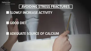 Doctors seeing more stress fractures in kids
