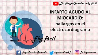 INFARTO AGUDO DE MIOCARDIO: Hallazgos electrocardiográficos.