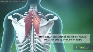 Upper Back Pain Reasons