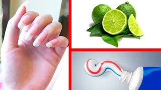 3 + 1 Tricks für gepflegte und gesunde Fingernägel!