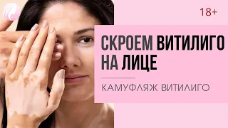 Как СКРЫТЬ пятна ВИТИЛИГО НА ЛИЦЕ? Камуфляж витилиго