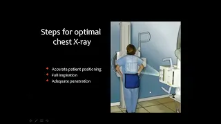 09. Chest Imaging Chest X Ray Techniques & Terminology, Dr. Mamdouh Mahfouz
