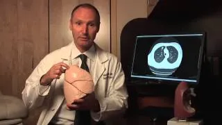 Lung Cancer Surgery