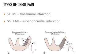 Chest Pain Rapid Review